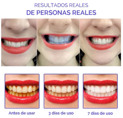 ✨Pasta Blanqueadora PRO Obsessive Smile® 🦷